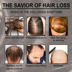 Rosemary Anti-loss Hair Growth