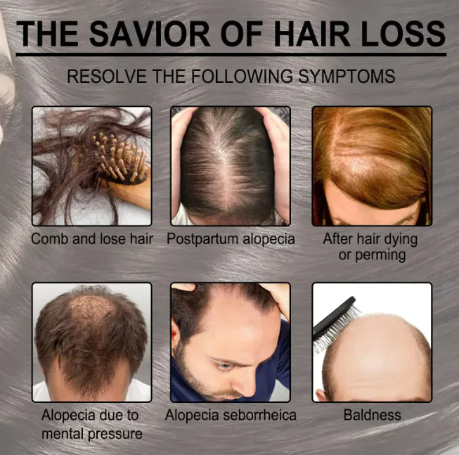 Rosemary Anti-loss Hair Growth